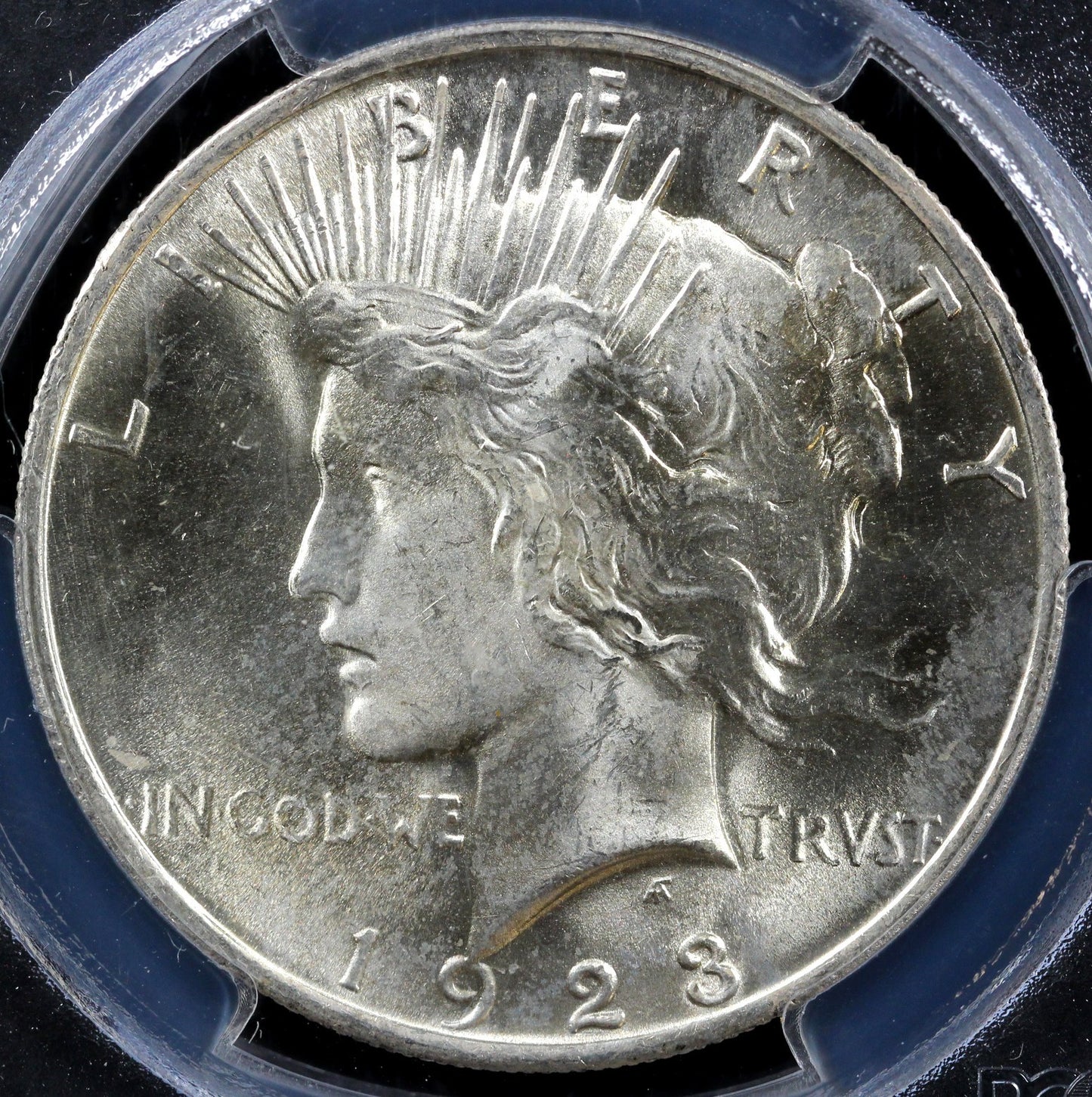 45177146